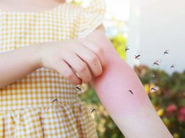 Zanzare come tenerle lontano dai bambini prodotti